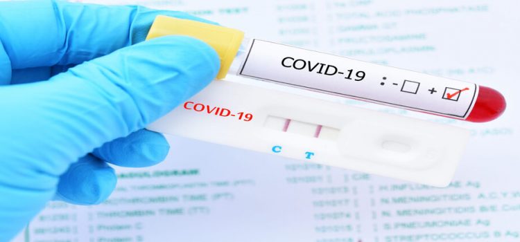 15 nuevos casos de Covid-19 en Sinaloa