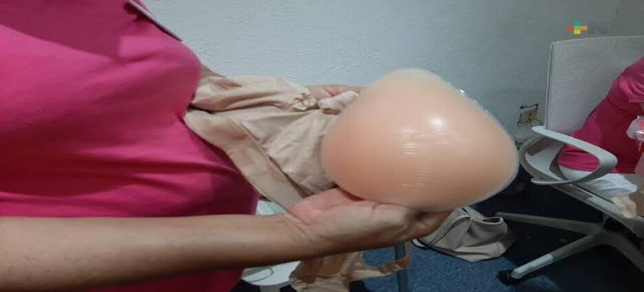 Immujeres realizará entrega de prótesis de mama gratuita a pacientes que lo soliciten