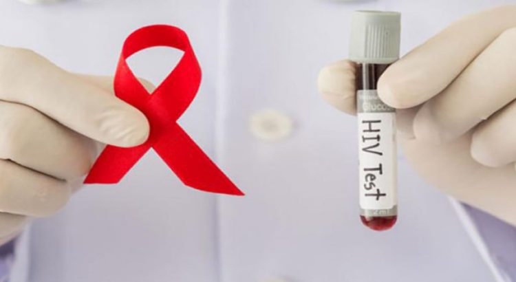 123 casos nuevos de VIH en el sur de Sinaloa